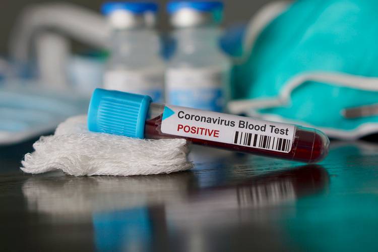 Coronavirus shutterstock website1 | Techlog.gr - Χρήσιμα νέα τεχνολογίας