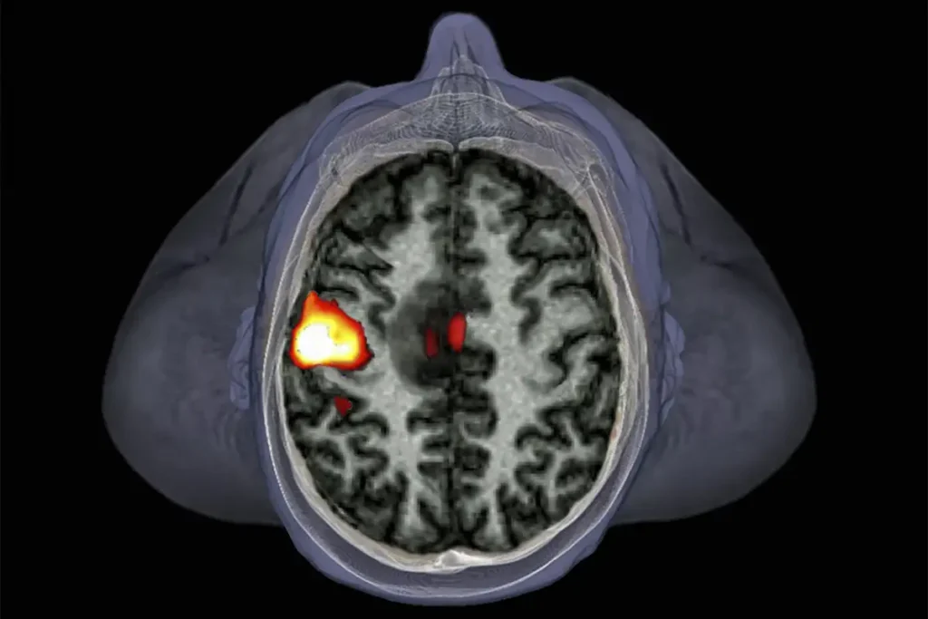 c0211947 brain tumour fmri scan spl | Techlog.gr - Χρήσιμα νέα τεχνολογίας